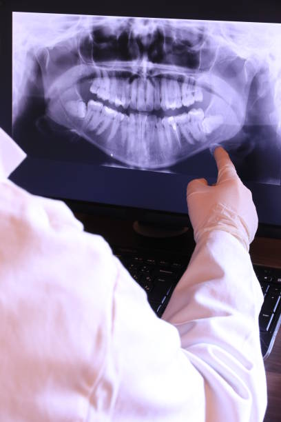 Best Emergency Gum Treatment in Canfield, OH